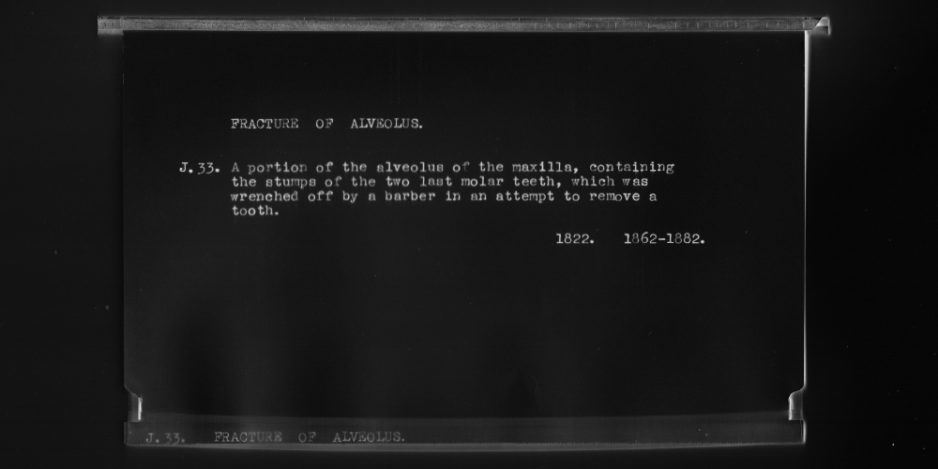 Suzanne Heath - On the Art of Teeth